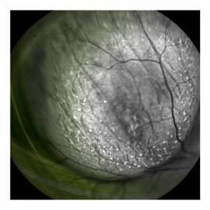 Fundus, 2011
