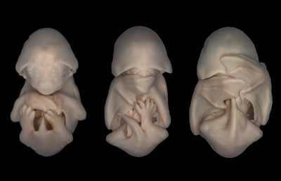 Wings on Their Fingers: Wing development in the black mastiff bat, 2006